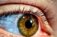 Mata Merah? Ini Cara Aman Mengatasinya di Rumah