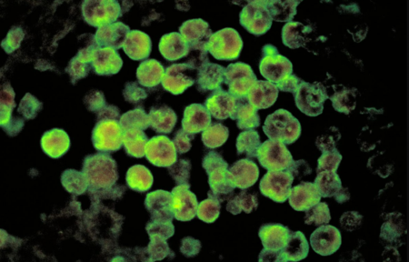 Bahaya Mikroba ‘Pemakan Otak’ di Sistem Air Dunia