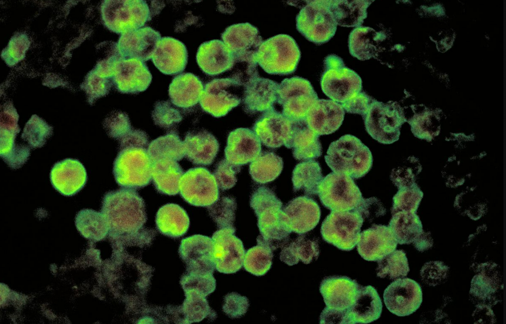 Bahaya Mikroba ‘Pemakan Otak’ di Sistem Air Dunia