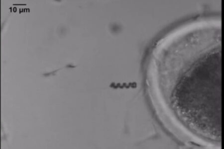 Ilmuwan Ciptakan Spermbot, Bantu Pasangan Sulit Hamil