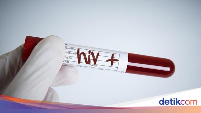 Deteksi Dini Wabah Baru di RI, Kemenkes Catat 62 Kasus Super Flu pada 2026